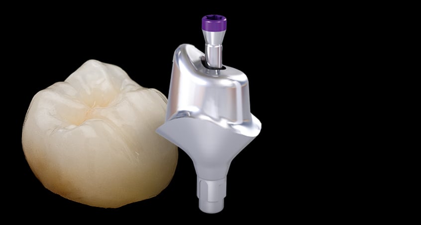Home Implant 2