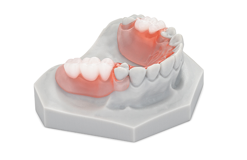 Printed  Flexible partial